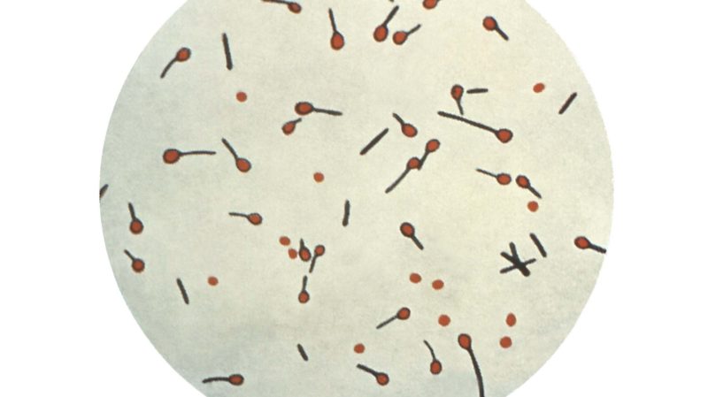 bacteria-tetano-cdc-800x449.jpg?profile=RESIZE_710x