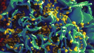 Micrografia eletrônica de partículas de HIV que infectaram uma célula T humana