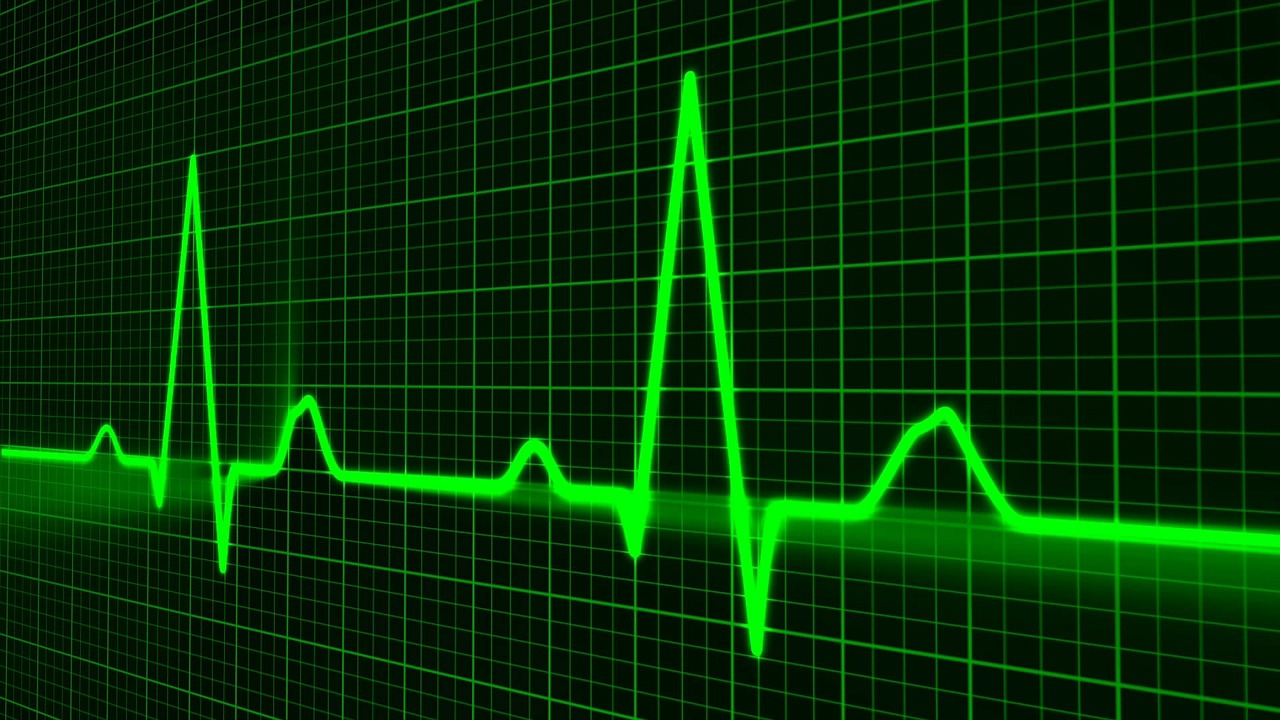 Imagem de monitor de atividade cardíaca