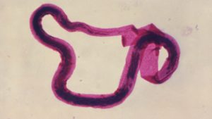 Fotomicrografia de Brugia malayi em forma larval, uma das várias lombrigas que podem causar filariose linfática