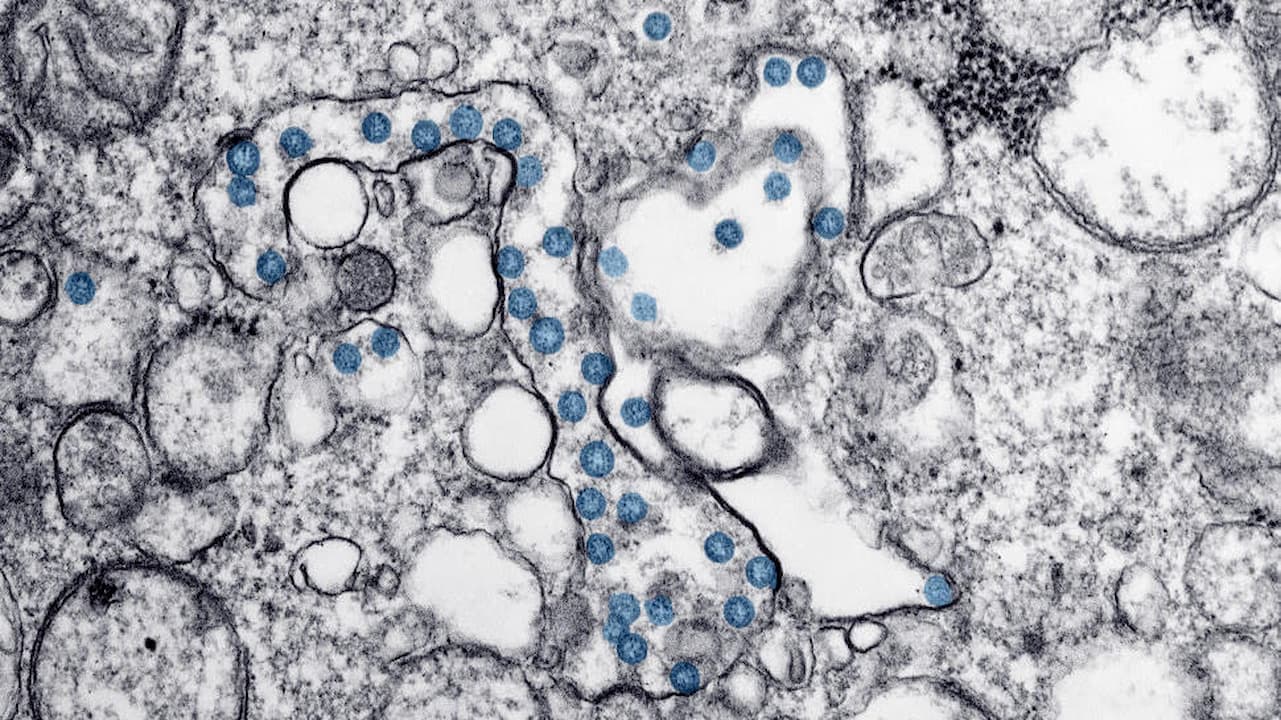Imagem microscópica do SARS-CoV-2