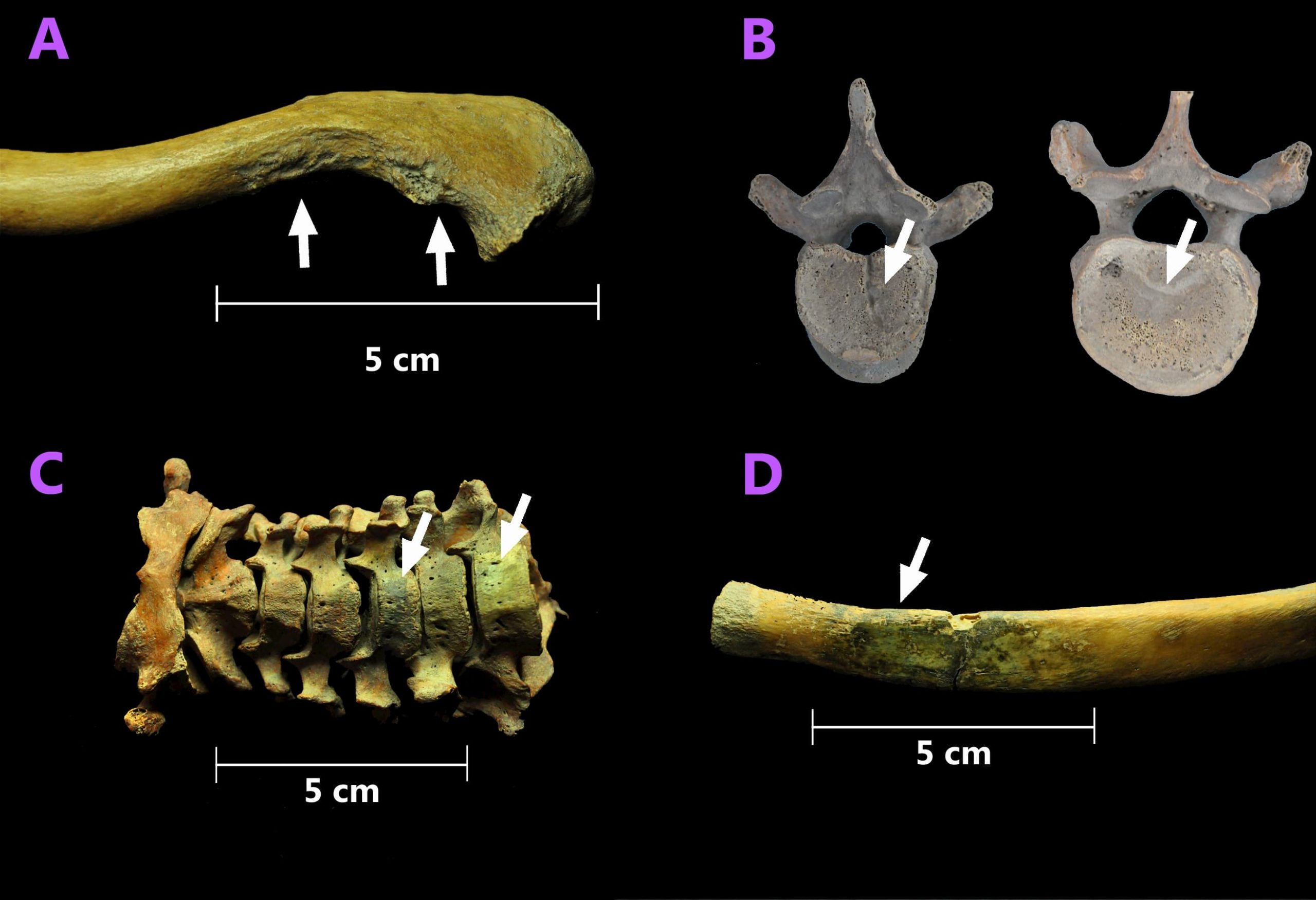 Imagens de quatro ossos com identificações de danos e desgastes.