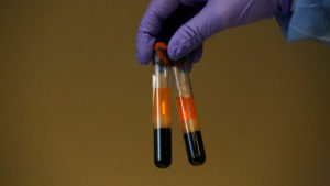 Amostras de sangue em dois tubos. Crédito: Getty Images