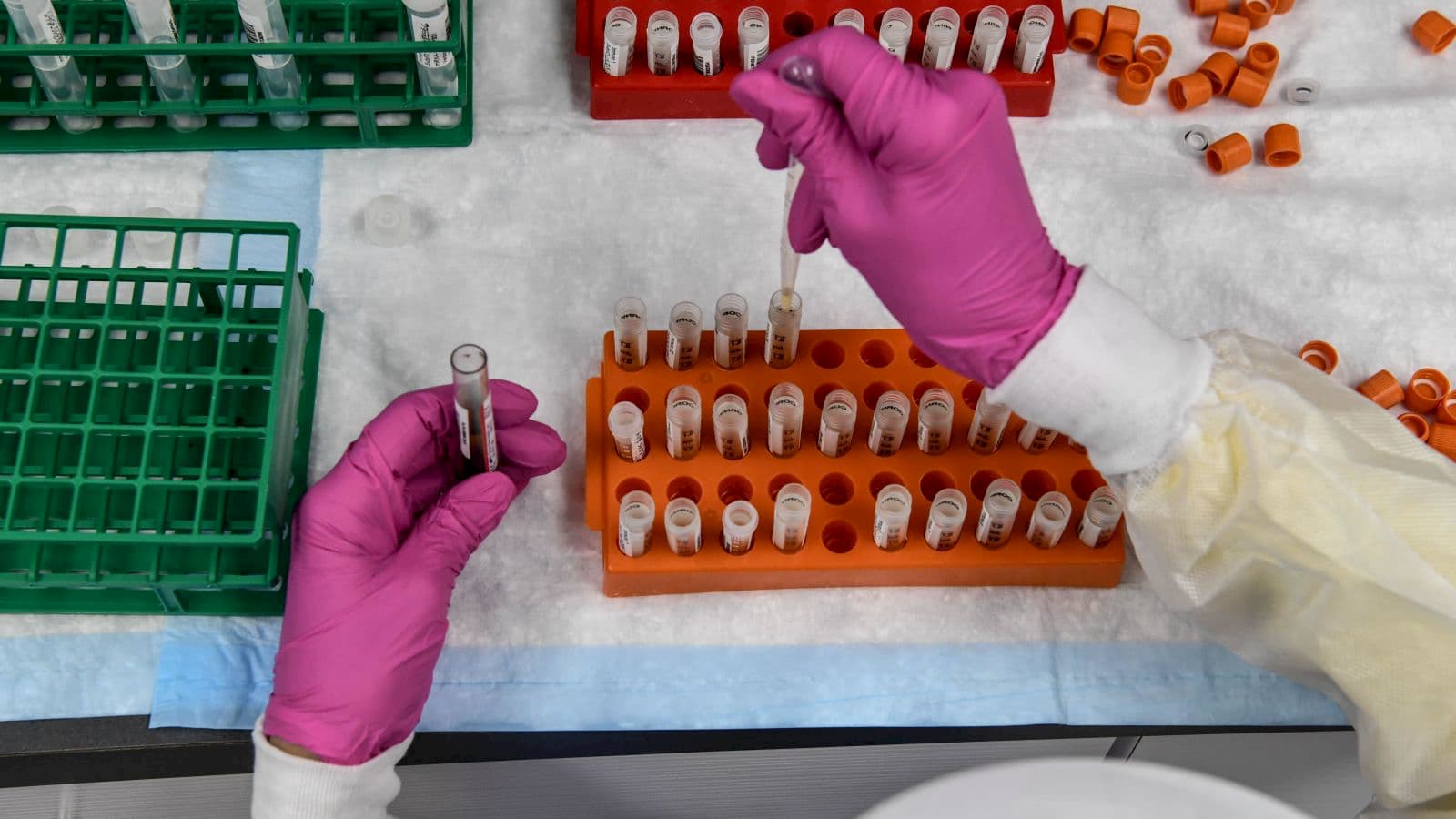 Um técnico de laboratório seleciona amostras de sangue para um estudo de vacina para COVID-19 nos Centros de Pesquisa da América em Hollywood, Flórida, em 13 de agosto de 2020