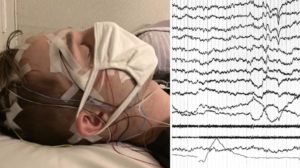 Sinais elétricos do cérebro de uma pessoa adormecida são mostrados no monitor. Imagem: K Konkoly