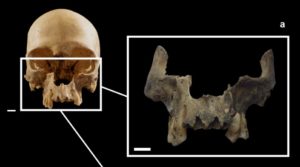 Visão anterior do crânio: ossos faciais nas vistas frontal (a). Imagem: Belcastro et al, 2021, PLOS ONE