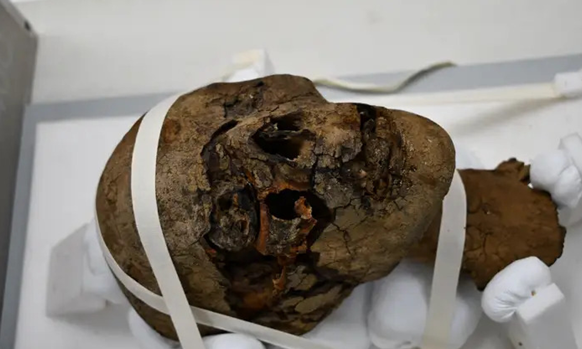 Imagem mostra cabeça decapitada de múmia presa em aparelho de tomografia.