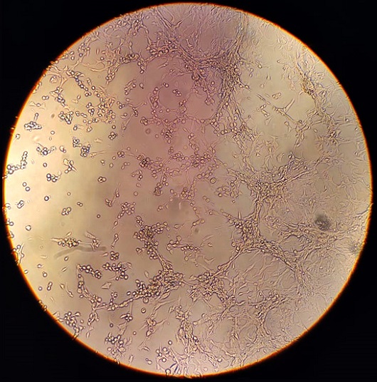 Friocruz fotografa vírus da varíola dos macacos