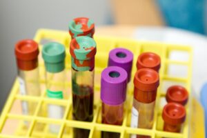 Novo rastreamento detecta câncer sem sintomas pelo exame de sangue