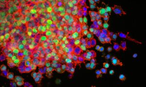 Vírus que destrói células tumorais se torna arma em potencial contra câncer