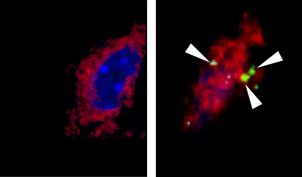 Imagens de neurônio (em vermelho) no hipotálamo ventromedial de camundongos em repouso (à esquerda) e depois do exercício (à direita), quando se detecta a presença da proteína IL-6 (em verde)