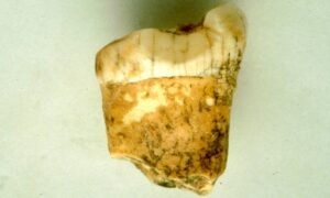 Neandertais carnívoros? Cientistas acham indícios no tártaro de um dente