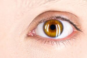 Pesquisadores associam hidroxicloroquina a problema ocular