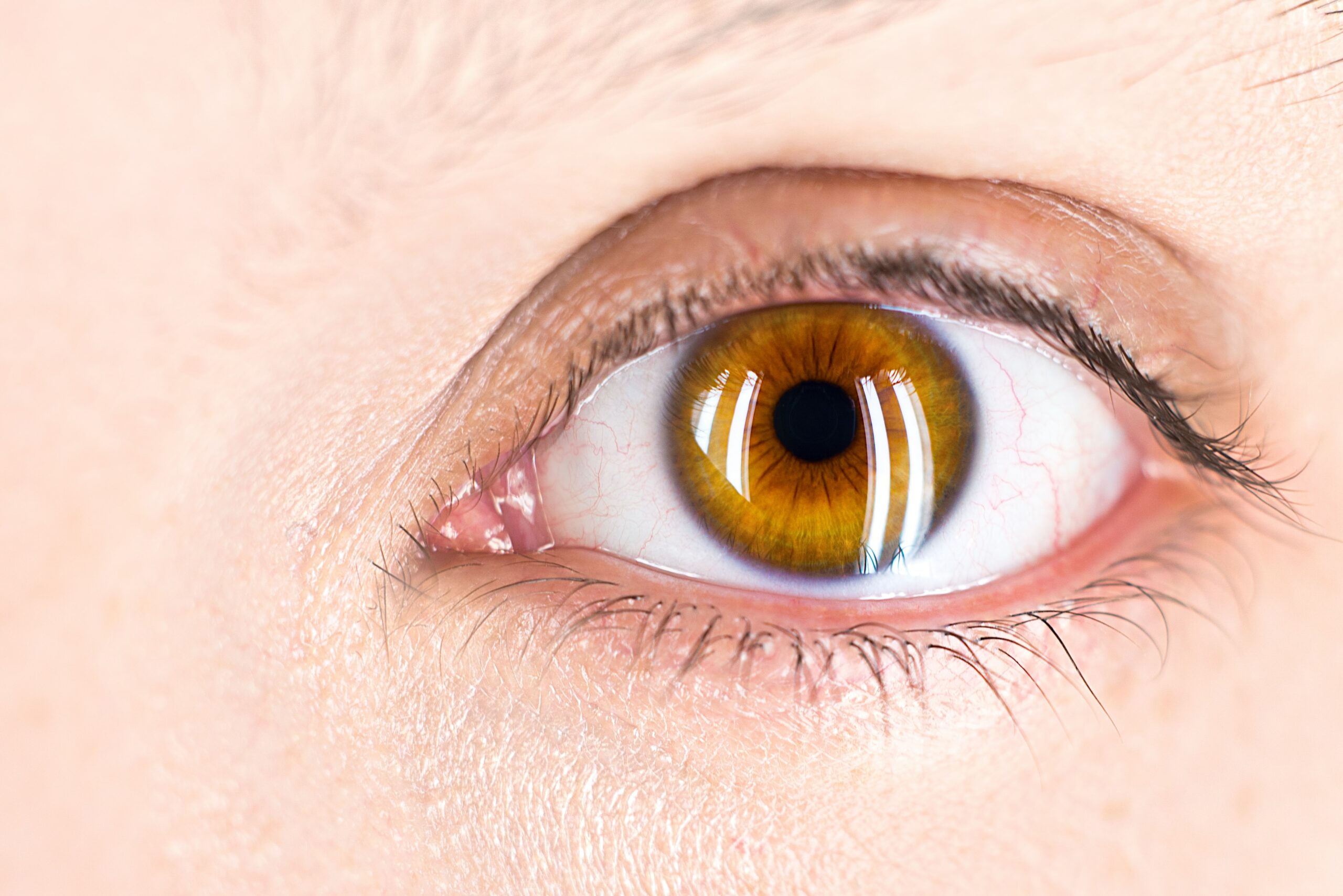Pesquisadores associam hidroxicloroquina a problema ocular