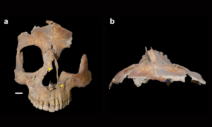 Crânio encontrado em Israel tem marcas de cirurgia cerebral feita há 3,5 mil anos