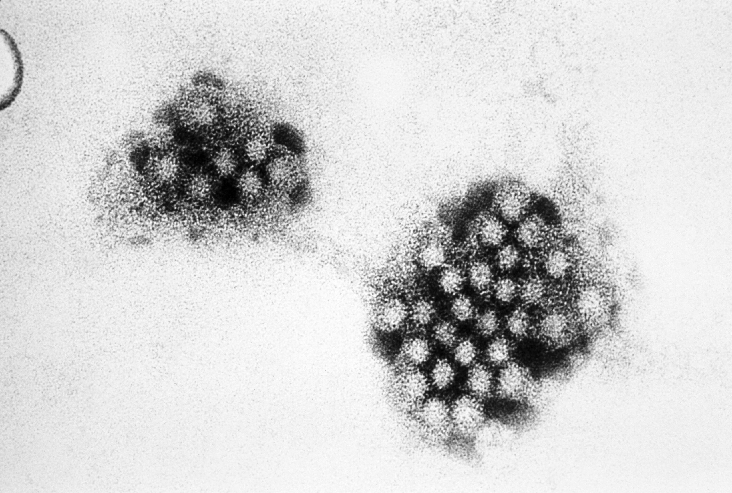 Norovirus: Get to know the disease that hit southern Brazil