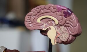 Estimulação cerebral pode ser alternativa para tratar TOC, mostra estudo da USP