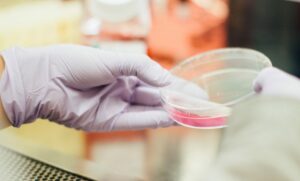 EUA registram aumento drástico de infecções por fungo que resiste a medicamentos
