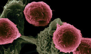 Pesquisadores testam ‘células artificiais’ no combate ao câncer
