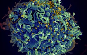 É possível eliminar o vírus HIV do organismo infectado?