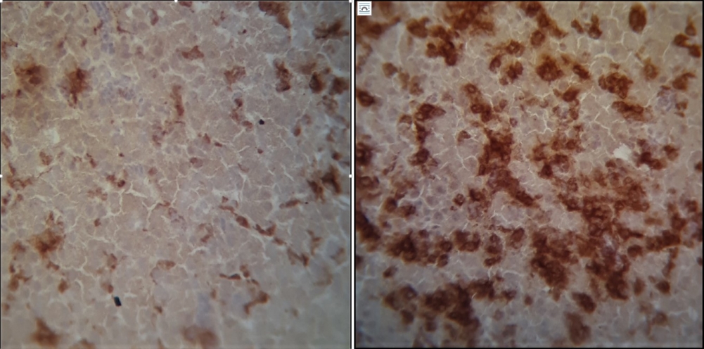 À esquerda, seção do ceco de ave de corte infectada por versão selvagem de Salmonella Enteritidis apresenta reações em macrófagos (partes mais escuras) 14 dias após a infecção. À direita, mutante da bactéria causa resposta imune mais acentuada 