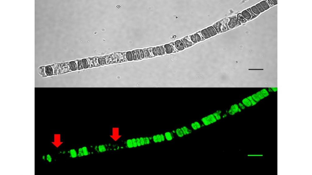 Microfotografia confocal do filamento de N. spumigena CENA596 (em cima) e fluorescência da clorofila (embaixo) após tratamento com glitter. As setas indicam células com ausência de fluorescência de clorofila 