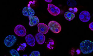 Atlas celulares mapeiam intestino, placenta e rins em detalhes inéditos