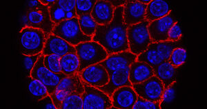 "Sobra" da divisão entre células pode gerar tumores cancerígenos e células cancerosas