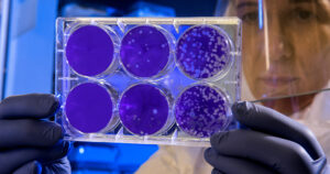 Mecanismo de defesa da célula pode ser base de tratamentos de câncer, diz estudo
