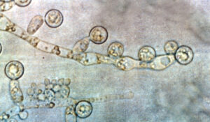 Inflamação em Covid-19 grave tem relação com fungos da microbiota, diz estudo