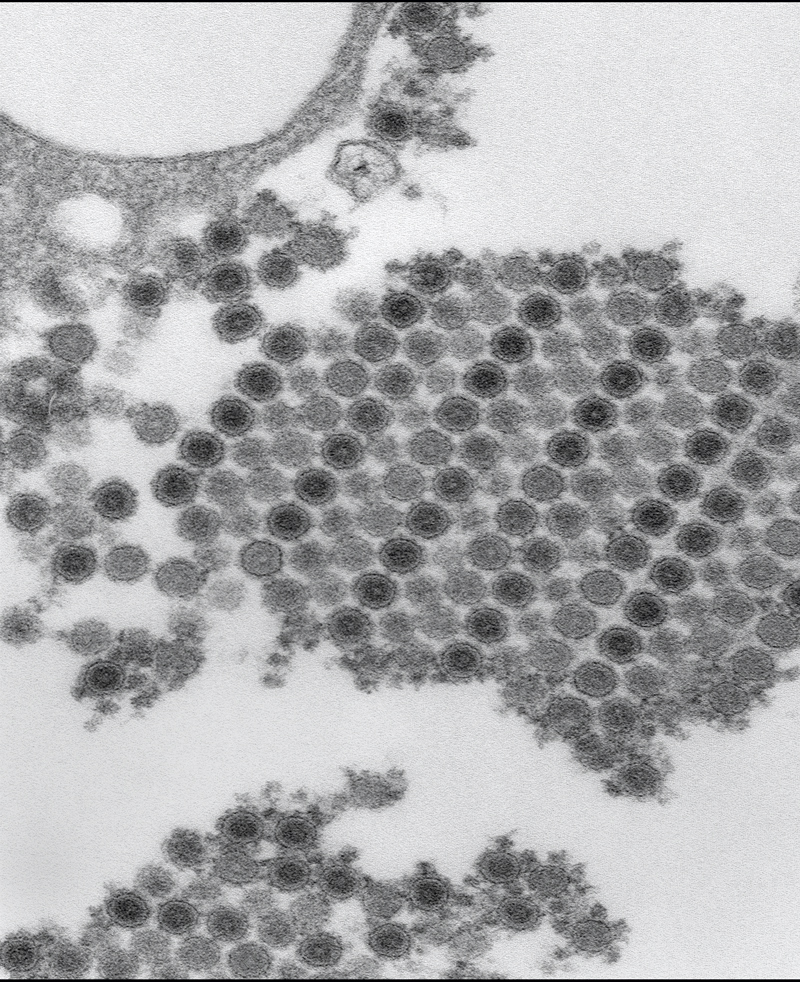 Cópias do vírus da chikungunya, vistas ao microscópio eletrônico, que causa inflamação e dores intensas nas articulações