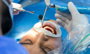 Cirurgia precoce para corrigir abertura no céu da boca reduz problema de fala