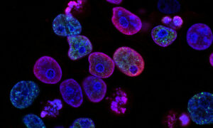 Cientistas encontram célula que ajuda a prever cura do câncer de pele