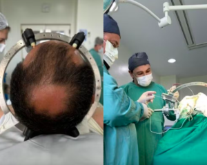 Brasileiro recebe chip cerebral para tratamento de TOC pela 1ª vez em Santa Catarina