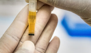 Cientistas encontram enzima responsável por deixar o xixi amarelo