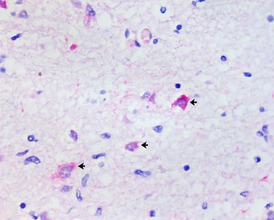  Em amostra de cérebro de gambá (Didelphis albiventris), imagem feita com microscópio indica antígenos do vírus da raiva em neurônios (indicados por setas) 
