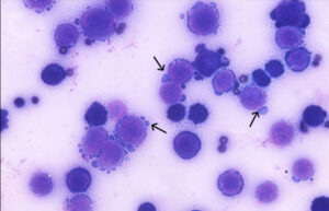 Toxina do veneno da cascavel induz célula de defesa a combater o câncer, indica estudo
