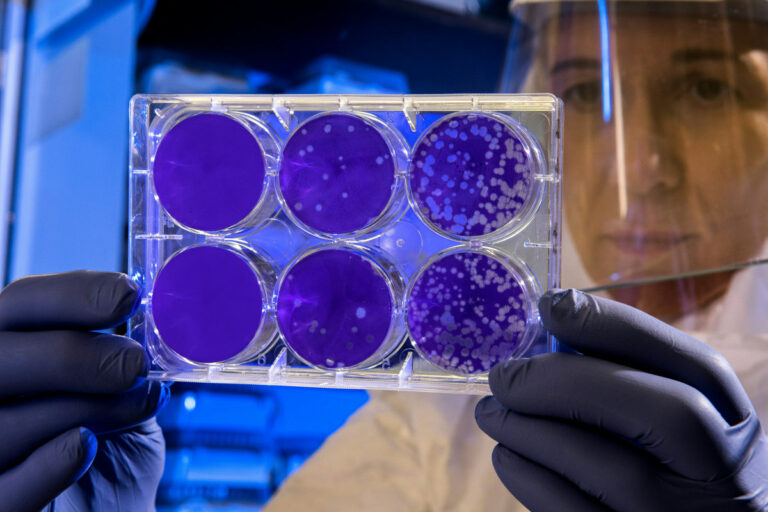 Nanopartículas com ação antibacteriana encurtam tratamento da tuberculose