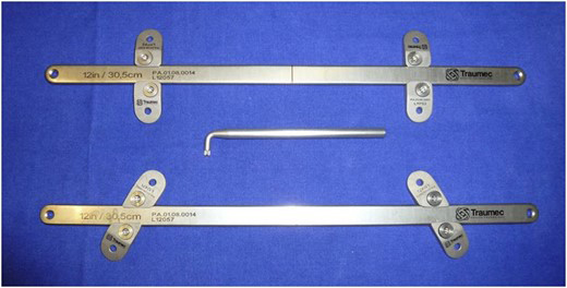 Conjunto de barra metálica e estabilizadores de titânio desenvolvidos pela indústria brasileira - 