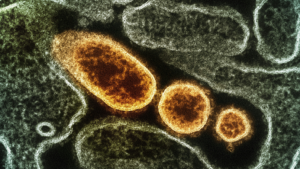 O vírus Nipah é considerado extremamente contagioso, segundo a OMS