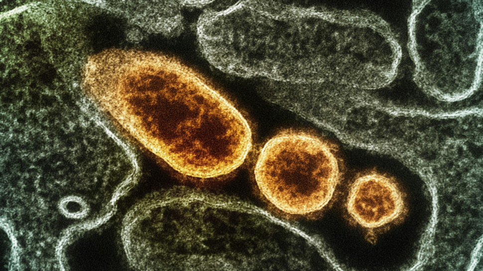 Qué es el Nipah, un virus vigilado por la Organización Mundial de la Salud y altamente transmisible