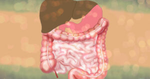 Micropartícula reforçada com escudo de silício chega ao intestino e reduz efeitos de inflamação