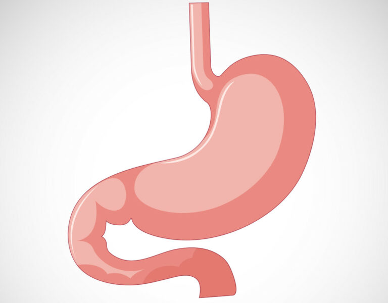 Estudo revela causa de uma das principais complicações da cirurgia bariátrica