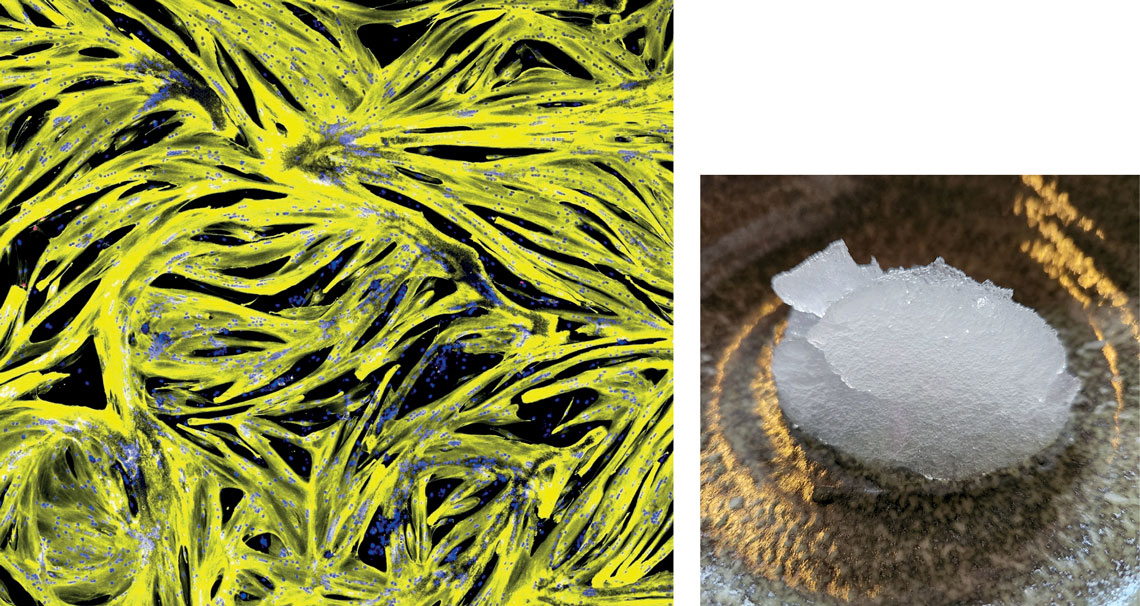 Multiplicação de células musculares (núcleos em azul) em meio de cultura proteico (amarelo) da Mosa Meat; e gordura cultivada suína da cellva (à dir.)