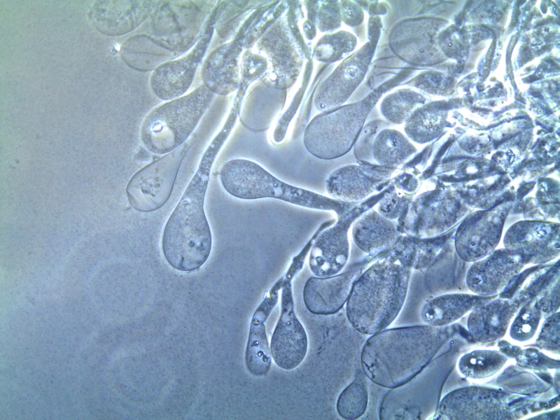 Imagem aumentada em mil vezes mostra vesículas nutritivas (gongilídeos) produzidas pelo fungoLeucoagaricus gongylophorus, cultivado pela saúva-limão (Atta sexdens) 