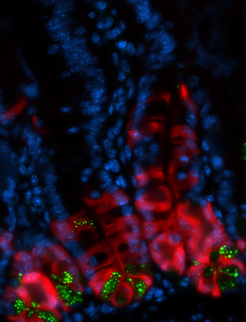 Análise histológica do epitélio intestinal usada para quantificar a atividade das células-tronco em diferentes condições de alimentação. Em vermelho, as células-tronco e as células progenitoras (geradas pelas células-tronco) após administração de um reagente específico em camundongos. Um maior número de células vermelhas indica uma maior taxa de proliferação das células-tronco. Em verde, as células de Paneth que desempenham funções de auxílio e proteção às células-tronco 