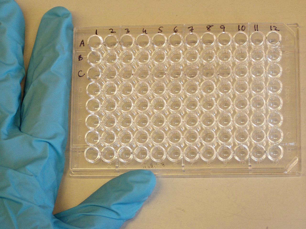 Teste permite identificar infecção prévia por zika e pelos quatro sorotipos do vírus da dengue